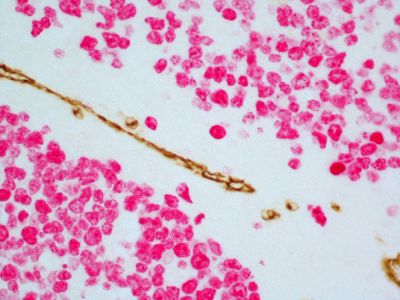 ImmPRESS? Duet Double Staining Polymer Kit (HRP – Anti-Rabbit IgG-brown, AP – Anti-Mouse IgG-magenta)