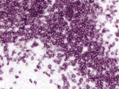 DuoLuX? Chemiluminescent and Fluorescent Substrate, Peroxidase (HRP)
