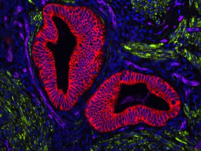 VECTASHIELD? HardSet™ Antifade Mounting Medium with Phalloidin
