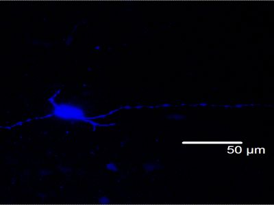NEUROBIOTIN?-PLUS Tracer