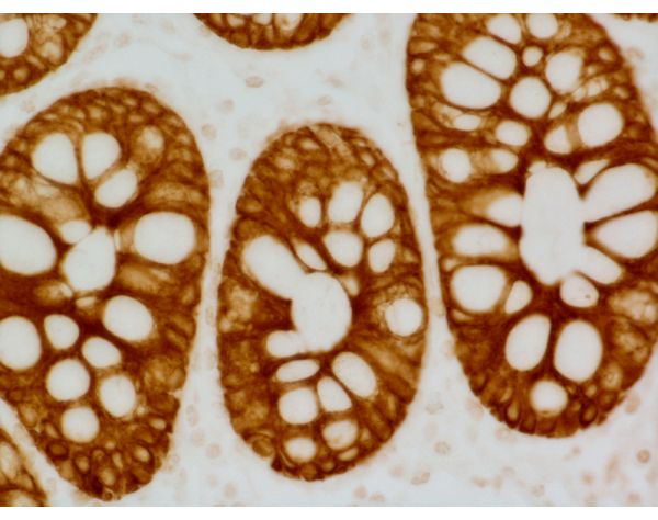 ImmPRESS? HRP Goat Anti-Mouse IgG Polymer Detection Kit, Peroxidase