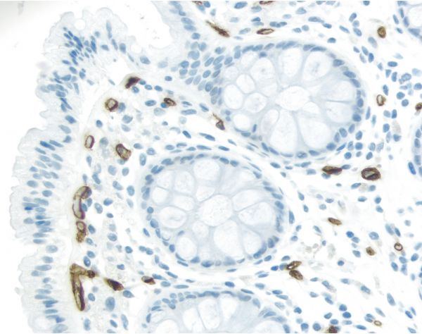 ImmPRESS? Excel Amplified Polymer Staining Kit, Anti-Mouse IgG, Peroxidase