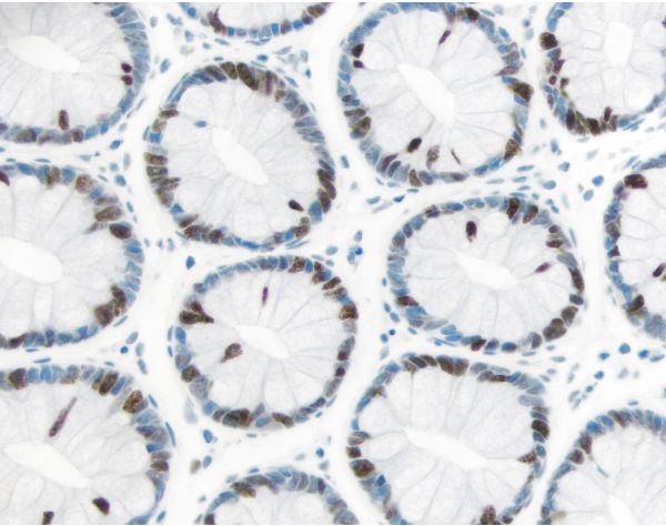 ImmPRESS? Excel Amplified Polymer Staining Kit, Anti-Rabbit IgG, Peroxidase