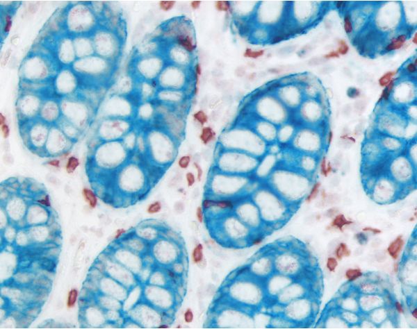 ImmPRESS?-AP Horse Anti-Mouse IgG Polymer Detection Kit, Alkaline Phosphatase