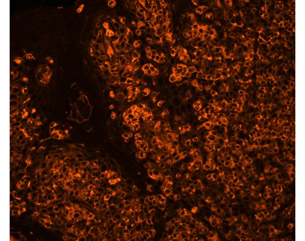 Sambucus Nigra Lectin (SNA, EBL), CY?3