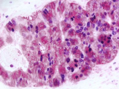 ImmPRESS?-AP Goat Anti-Rat IgG (Mouse Adsorbed) Polymer Detection Kit, Alkaline Phosphatase