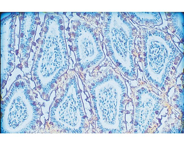 Jacalin, Unconjugated