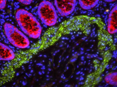 VECTASHIELD? Vibrance™ Antifade Mounting Medium with DAPI