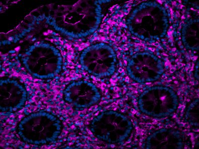 Sambucus Nigra Lectin (SNA, EBL), Agarose bound