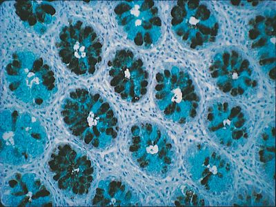 Dolichos Biflorus Agglutinin (DBA), Rhodamine