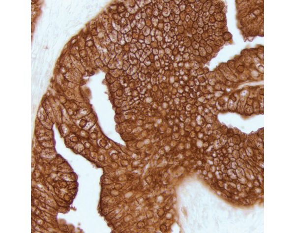 ImmPACT? DAB EqV Peroxidase (HRP) Substrate