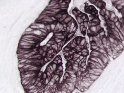 Alkaline Phosphatase Avidin D