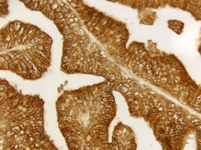 DAB Enhancing Solution