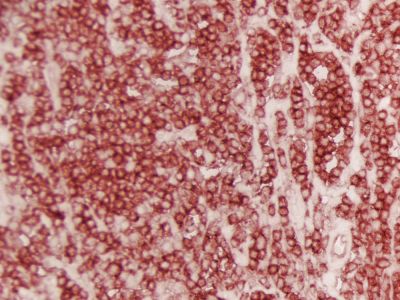 DAB Enhancing Solution