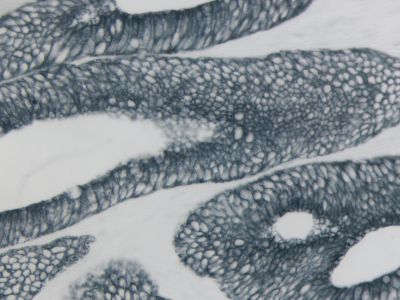 VECTASTAIN? Elite ABC-HRP Kit, Peroxidase (Human IgG)