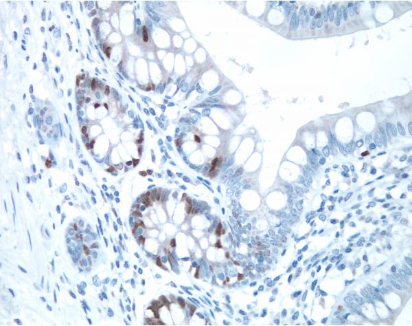 VECTASTAIN? Elite ABC-HRP Kit, Peroxidase (Rabbit IgG)