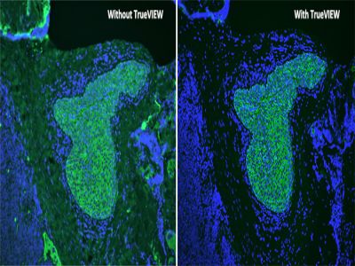 Vector? TrueVIEW? Autofluorescence Quenching Kit