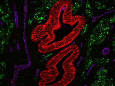 Vector? TrueVIEW? Autofluorescence Quenching Kit