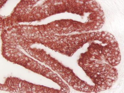 VECTASTAIN? Elite ABC-HRP Kit, Peroxidase (Mouse IgG)