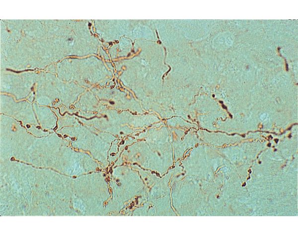 Goat Anti-Phaseolus Vulgaris Agglutinin (E+L), Unconjugated