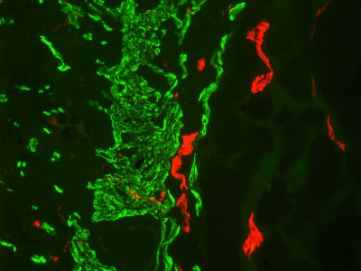 M.O.M.? (Mouse on Mouse) Blocking Reagent