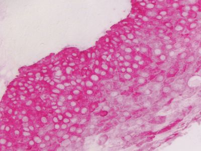 VECTASTAIN? ABC-AP Kit, Alkaline Phosphatase (Rat IgG)