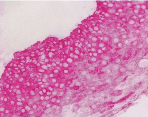 Vector? Red Substrate Kit, Alkaline Phosphatase (AP)