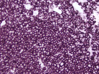 VECTASTAIN? ABC-HRP Kit, Peroxidase (Mouse IgG)