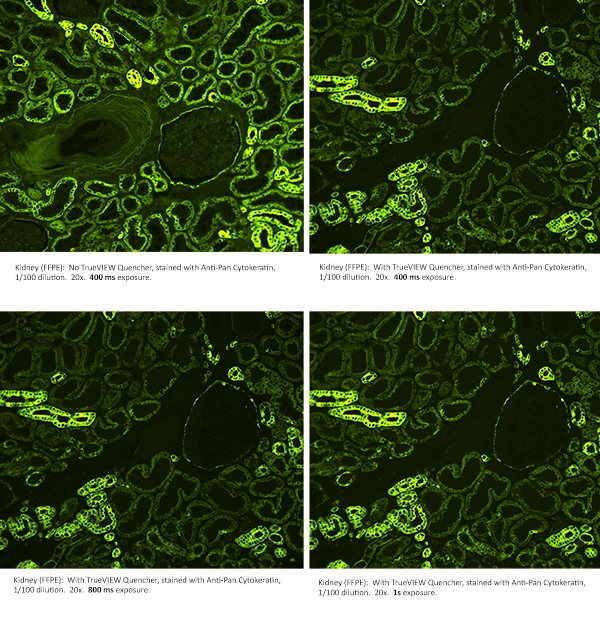 TrueView Optimization of Exposure Vector? TrueVIEW? Autofluorescence Quenching Kit with DAPI