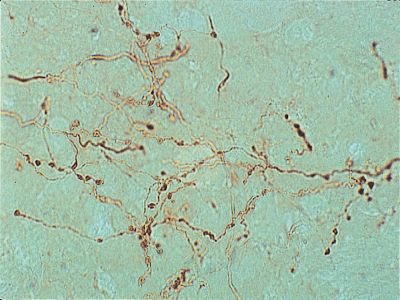 Rabbit Anti-Phaseolus Vulgaris Agglutinin (E+L), Unconjugated